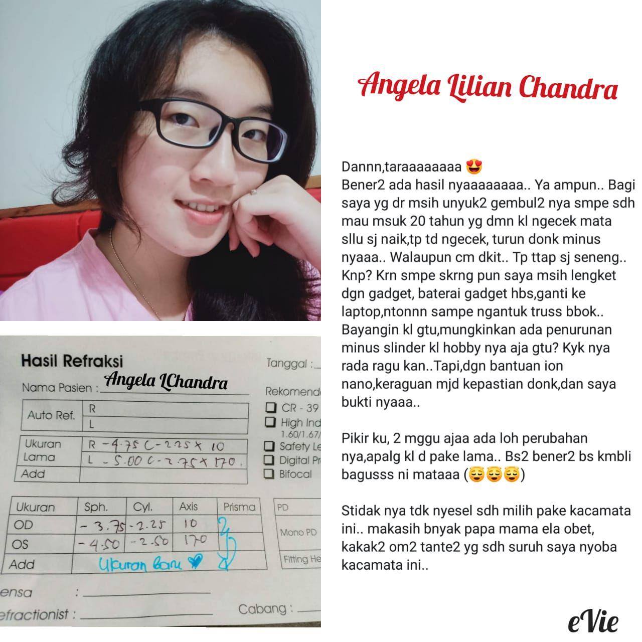 cara mengobati mata berair dan silindris